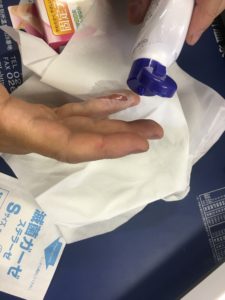 やけど傷