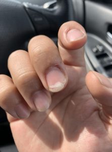 爪が向けました